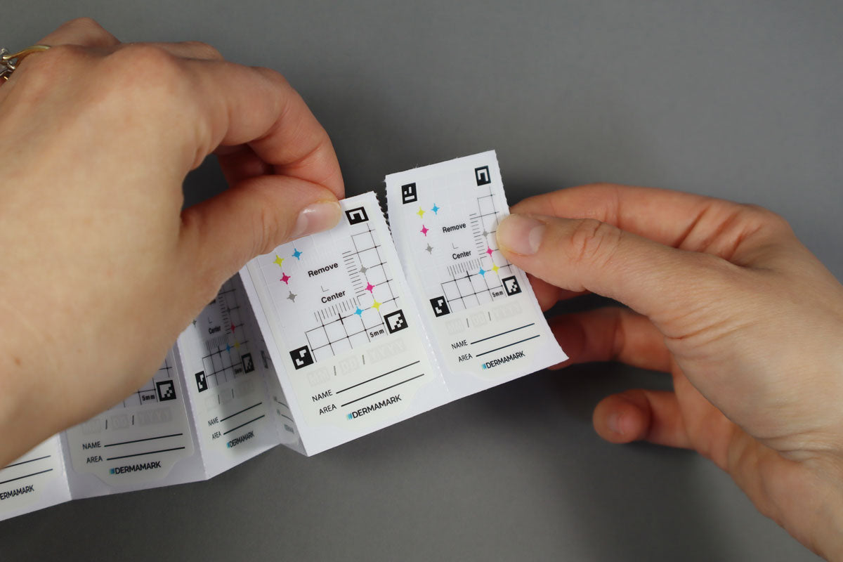 Hands holding Dermamark skin tracking stickers with color markers and measurement grids for mole monitoring