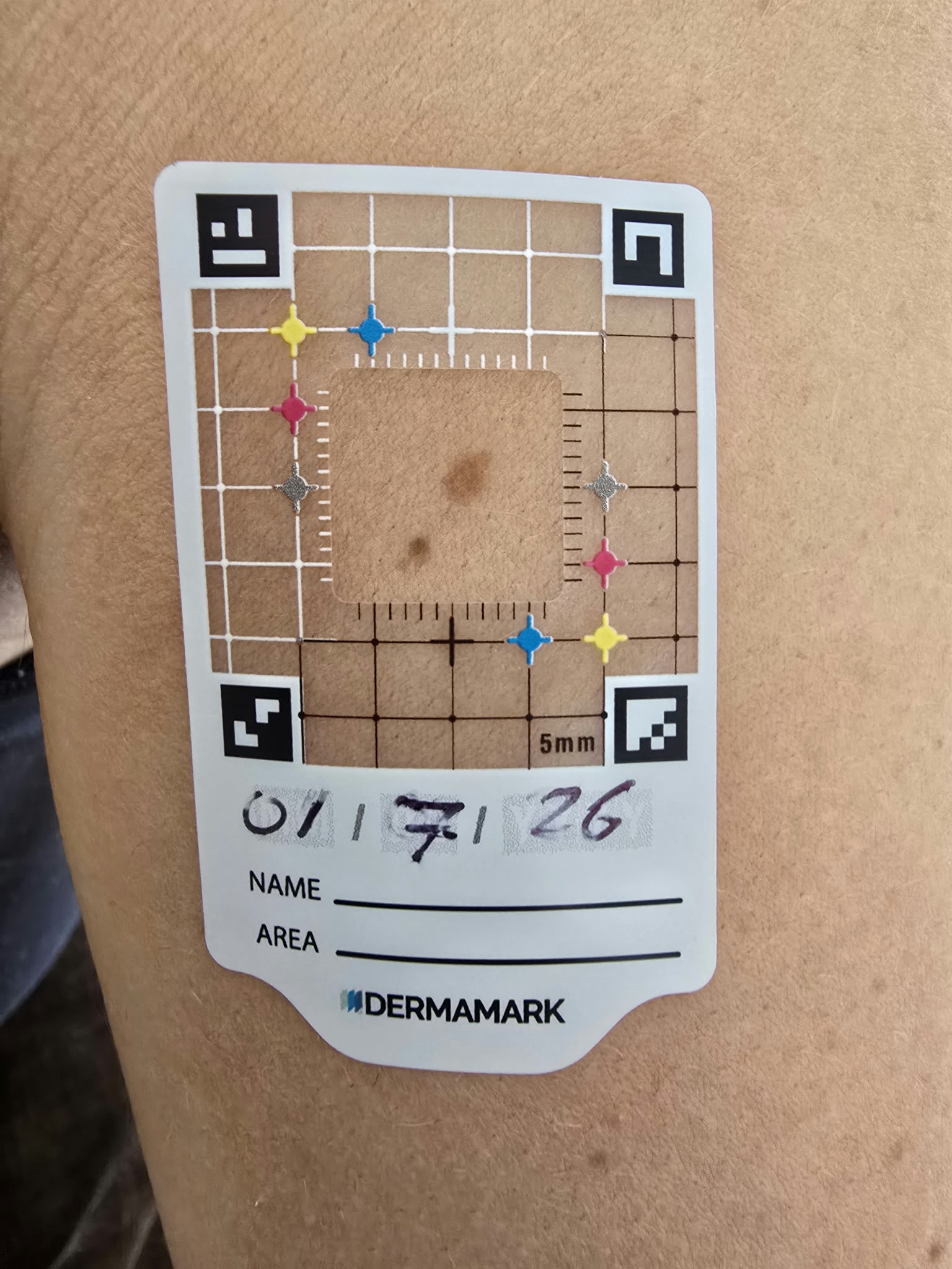 
                      With Dermamark | Today
                    